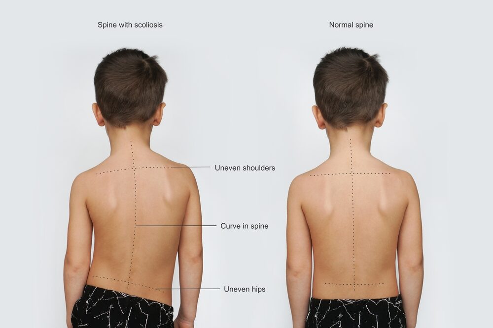 Strength, flexibility, and posture
