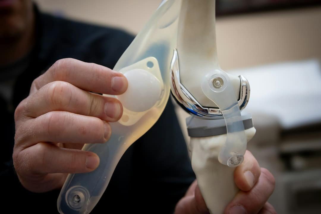 Custom Bracing & Orthotics 1 Man examines a knee joint model